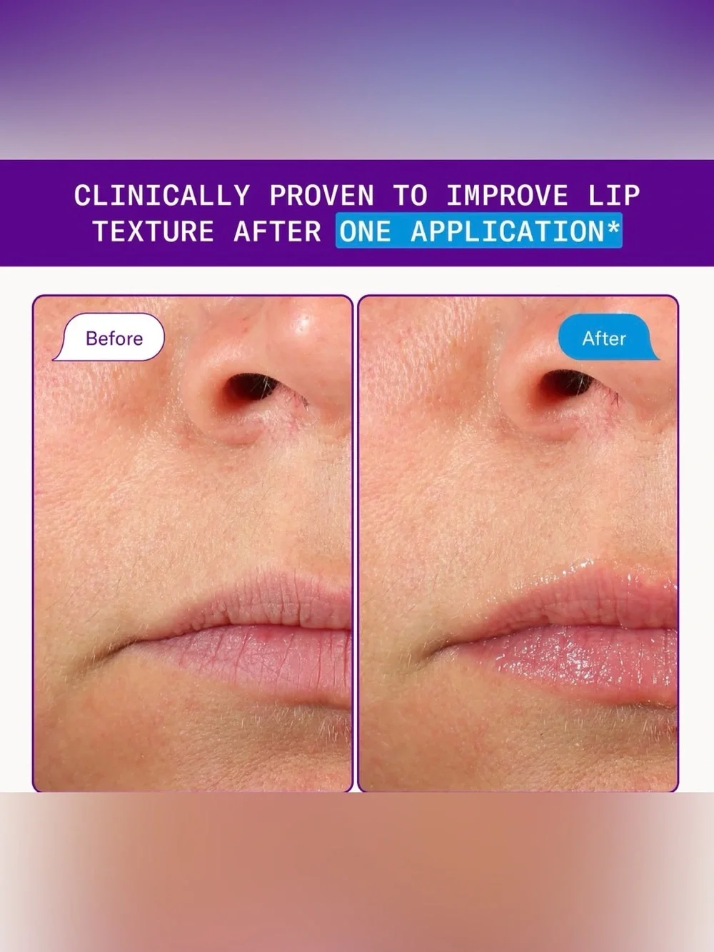 Dr!driss Barrier Baste Treatment Lip Basting Balm
